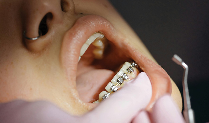 Preventive Dentistry